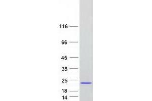 Validation with Western Blot