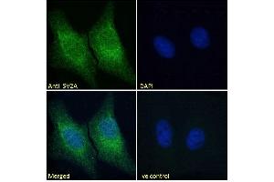 ABIN185715 Immunofluorescence analysis of paraformaldehyde fixed U2OS cells, permeabilized with 0. (SV2A anticorps  (Internal Region))