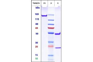 Anti-TREM2 Reference Antibody (Py314) on SDS-PAGE under reducing (R) condition. (Recombinant TREM2 anticorps)