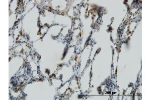 Immunoperoxidase of monoclonal antibody to PX19 on formalin-fixed paraffin-embedded human lung.