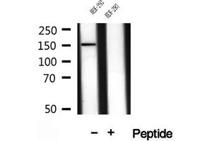 Western blot analysis of extracts of HEK-293 cells, using VPRBP antibody. (VPRBP anticorps)