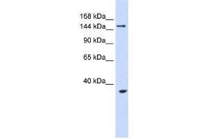 Western Blotting (WB) image for anti-Ubiquitin Protein Ligase E3B (UBE3B) antibody (ABIN2458742) (UBE3B anticorps)