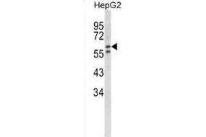 Western Blotting (WB) image for anti-Hexosaminidase A (HEXA) antibody (ABIN3002900) (Hexosaminidase A anticorps)