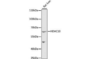 Western blot analysis of extracts of rat liver, using HDAC10 antibody (ABIN1882316) at 1:1000 dilution. (HDAC10 anticorps)