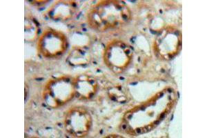 Used in DAB staining on fromalin fixed paraffin-embedded Kidney tissue (ACE2 anticorps  (AA 93-464))