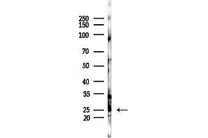 anti-Solute Carrier Family 31 (Copper Transporters), Member 1 (SLC31A1) (pThr114) antibody