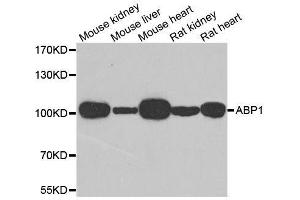 Western blot analysis of extracts of various cell lines, using AOC1 antibody. (DAO anticorps  (AA 20-300))