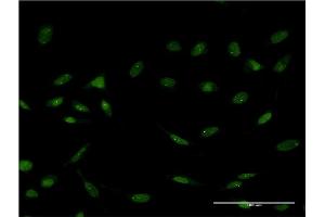 Immunofluorescence of monoclonal antibody to FOXC2 on HeLa cell.