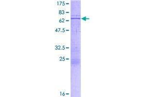 Image no. 1 for Chromobox Homolog 4 (CBX4) (AA 1-290) protein (GST tag) (ABIN1348212)