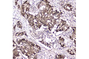 IHC analysis of GLO1 using anti-GLO1 antibody .