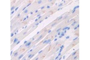 IHC-P analysis of Mouse Tissue, with DAB staining. (CACNA1C anticorps  (AA 1978-2139))