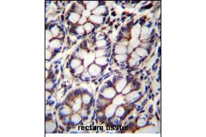 IQCA1 Antibody (C-term) (ABIN655947 and ABIN2845334) immunohistochemistry analysis in formalin fixed and paraffin embedded human rectum tissue followed by peroxidase conjugation of the secondary antibody and DAB staining. (IQCA1 anticorps  (C-Term))