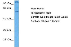 Host: Rabbit Target Name: RELA Sample Tissue: Mouse Testis Antibody Dilution: 1ug/ml (NF-kB p65 anticorps  (Middle Region))