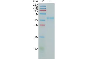 Human Protein, hFc Tag on SDS-PAGE under reducing condition.