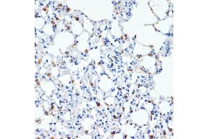 Immunohistochemistry of paraffin-embedded mouse lung using SFTPC antibody (ABIN3015597, ABIN3015598, ABIN3015599, ABIN1682683 and ABIN6218961) at dilution of 1:200 (40x lens).