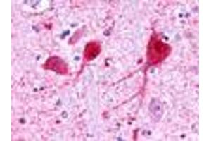 Anti-GALR3 antibody IHC of human brain, neurons and glia. (GALR3 anticorps  (C-Term))