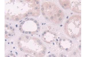 Detection of NQO1 in Human Kidney Tissue using Polyclonal Antibody to NADH Dehydrogenase, Quinone 1 (NQO1)