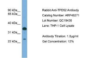 WB Suggested Anti-TPD52  Antibody Titration: 0. (TPD52 anticorps  (C-Term))
