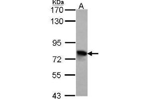 WB Image Sample (30 ug of whole cell lysate) A: Hela 7. (TGFBI anticorps)