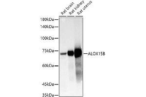 Western blot analysis of extracts of various cell lines, using B antibody (ABIN6129899, ABIN6136816, ABIN6136817 and ABIN6222589) at 1:1000 dilution. (ALOX15B anticorps  (AA 1-200))