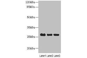 Western blot All lanes: C10orf82 antibody at 1 μg/mL Lane 1: A431 whole cell lysate Lane 2: HepG2 whole cell lysate Lane 3: Mouse thymus tissue Secondary Goat polyclonal to rabbit IgG at 1/10000 dilution Predicted band size: 27, 18, 13 kDa Observed band size: 27 kDa (RPAP2 anticorps  (AA 1-154))
