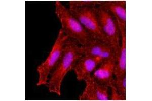 Immunofluorescenitrocellulosee of human HeLa cells stained with monoclonal anti-human KCDT15 antibody (1:500) with Texas Red (Red). (KCTD15 anticorps)
