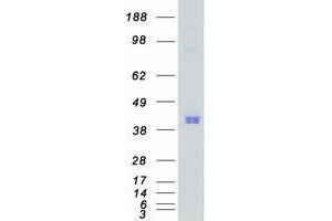 Validation with Western Blot