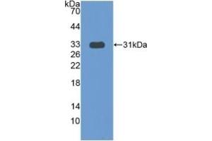 Detection of Recombinant COIL, Human using Polyclonal Antibody to Coilin (COIL) (Coilin anticorps  (AA 319-538))