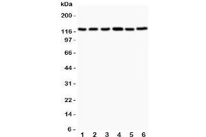 Western blot testing of Bub1 antibody and Lane 1:  rat testis;  2: (r) ovary;  3: (r) liver;  4: human Jurkat;  5: (h) COLO320;  6: (h) HEPG2. (BUB1 anticorps  (AA 731-1085))