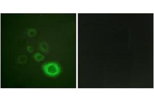 Immunofluorescence analysis of HepG2 cells, using c-Met (Phospho-Tyr1003) Antibody. (c-MET anticorps  (pTyr1003))