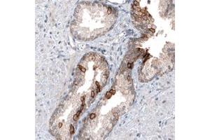 Immunohistochemical staining of human prostate shows moderate cytoplasmic positivity in glandular cells. (MUC4 anticorps)