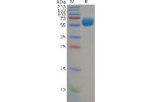 Human B7-H5 Protein, hFc Tag on SDS-PAGE under reducing condition.