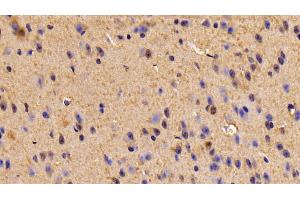Detection of TUBb6 in Mouse Cerebrum Tissue using Polyclonal Antibody to Tubulin Beta 6 (TUBb6)