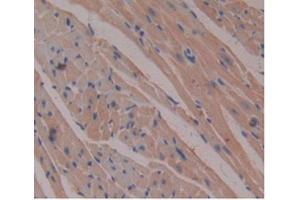 DAB staining on IHC-P Samples:Mouse Heart Tissue)