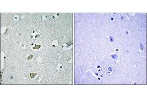 Immunohistochemistry analysis of paraffin-embedded human brain tissue, using KCNJ2 Antibody. (KCNJ2 anticorps  (AA 81-130))