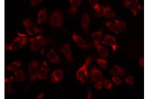 ABIN6274787 staining COLO205 by IF/ICC. (ABHD11 anticorps  (C-Term))