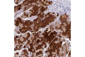Immunohistochemical staining of human stomach with VKORC1 polyclonal antibody  shows strong cytoplasmic positivity in glandular cells.