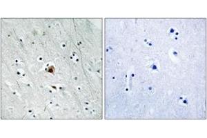 Immunohistochemistry analysis of paraffin-embedded human brain, using MAPKAPK2 (Phospho-Ser272) Antibody.
