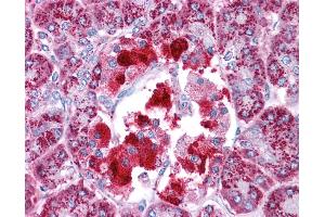 Immunohistochemistry (IHC) image for anti-Hydroxyacyl-CoA Dehydrogenase/3-Ketoacyl-CoA Thiolase/enoyl-CoA Hydratase (Trifunctional Protein), beta Subunit (HADHB) (C-Term) antibody (ABIN2783232)