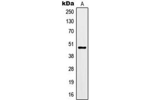 Western blot analysis of Kir3. (KCNJ9 anticorps  (Center))