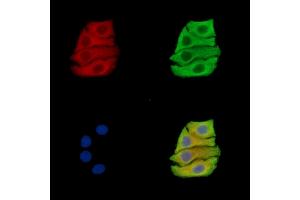 ABIN7096367 and ABIN7100430 staining Hela cells by IF/ICC. (TRIB1 anticorps)