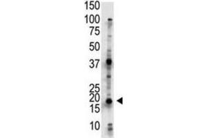 Western Blotting (WB) image for anti-Ubiquitin-Conjugating Enzyme E2G 2 (UBE2G2) antibody (ABIN3001458) (UBE2G2 anticorps)