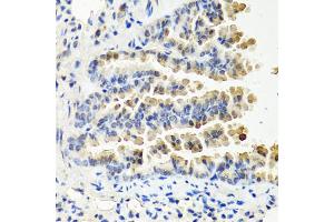 Immunohistochemistry of paraffin-embedded mouse lung using NTF3 antibody (ABIN6290616) at dilution of 1:100 (40x lens). (Neurotrophin 3 anticorps)