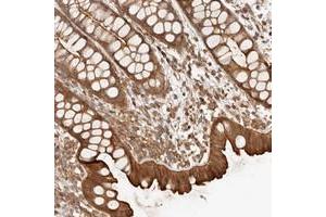 Immunohistochemical staining of human rectum with UFSP1 polyclonal antibody  shows strong cytoplasmic an membranous positivity in glandular cells. (UFSP1 anticorps)