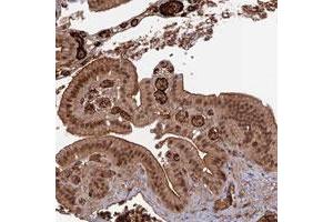 Immunohistochemical staining of human gallbladder with OSBPL1A polyclonal antibody  shows moderate cytoplasmic, membranous and nuclear positivity in glandular cells.