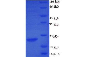 SDS-PAGE (SDS) image for Matrix Metallopeptidase 7 (Matrilysin, Uterine) (MMP7) (AA 98-267) protein (GST tag) (ABIN5709949)