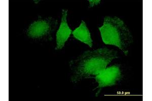 Immunofluorescence of purified MaxPab antibody to CNN2 on HeLa cell.
