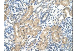 Immunohistochemistry (IHC) image for anti-Ketohexokinase (KHK) (C-Term) antibody (ABIN2776775)