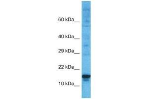 Host:  Rabbit  Target Name:  PRDM5  Sample Type:  ACHN Whole Cell lysates  Antibody Dilution:  1. (PRDM5 anticorps  (N-Term))