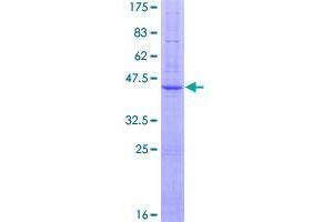 Image no. 1 for Bardet-Biedl Syndrome 10 (BBS10) (AA 1-151) protein (GST tag) (ABIN1346467)